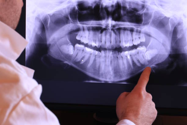 Best Emergency Tooth Extraction in Olton, TX
