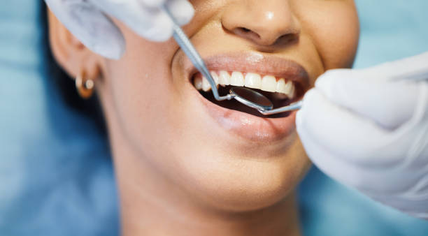 Best Emergency Dental Care for Broken or Chipped Teeth in Olton, TX